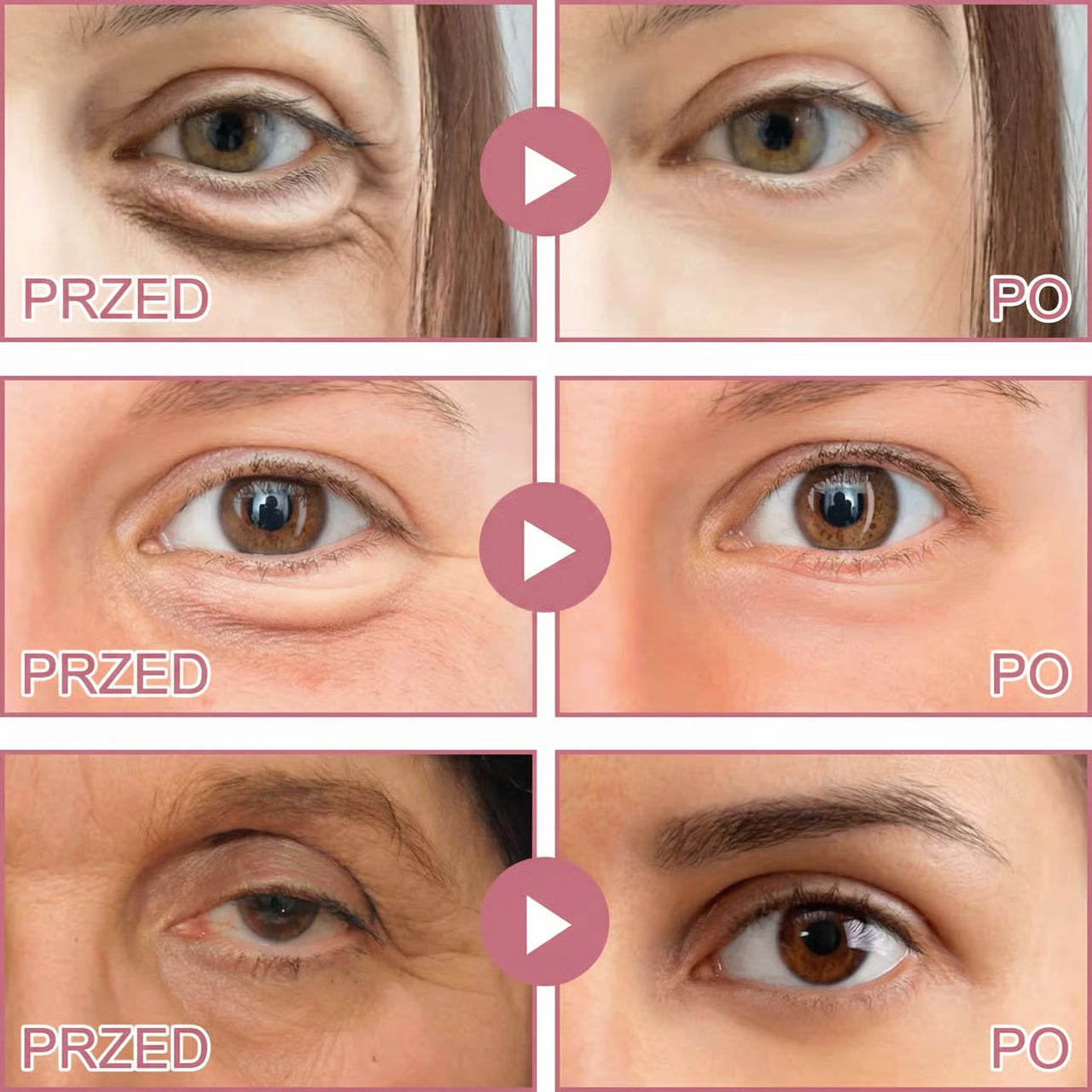 Płatki Mikroigłowe Glow Pod Oczy – Bageye