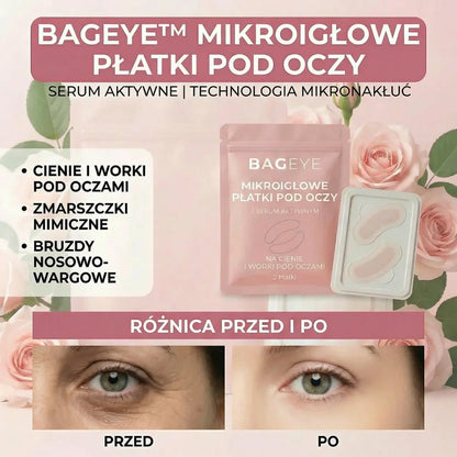 Płatki Mikroigłowe Glow Pod Oczy – Bageye